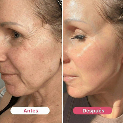 HerBloom™ El Nuevo Ritual Coreano | Resultados Nivel Botox en Casa